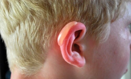 Что нужно делать, если у вас шелушатся уши – рассказывают специалисты