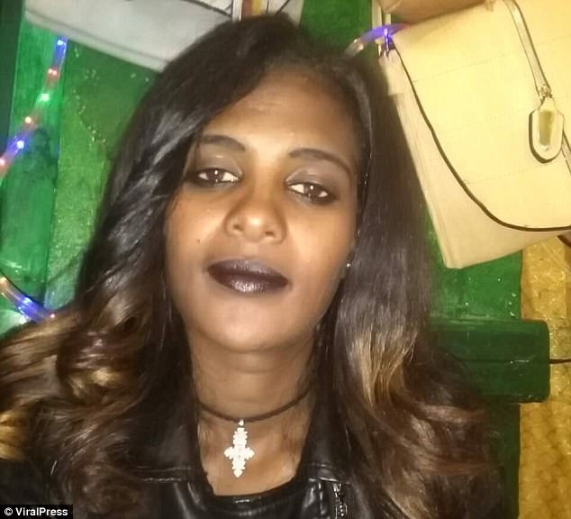 Atsede Nigussiem, 26, was at home in Ethiopia before the horrific acid attack by her own husband
