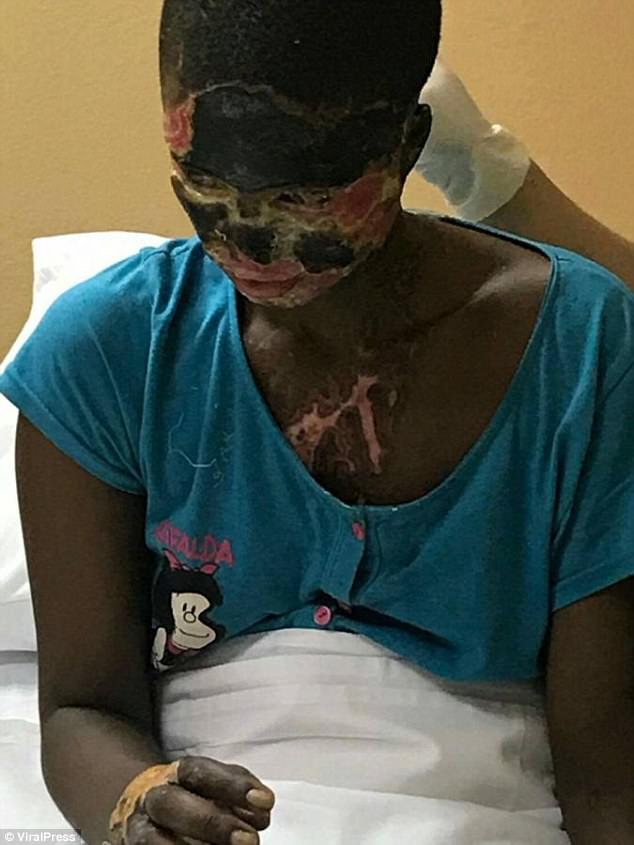 Atsede Nigussiem, 26, was at home in Tigrai, Ethiopia, when she opened the door to estranged partner Haimanot Kahsai, 29. Without warning he launched a sickening acid attack leaving his wife in agony as their five-year-old son Hannibal Kahsai slept inside