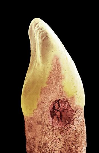 Фотографии зубов под микроскопом или как в действительности выглядит зубной налет